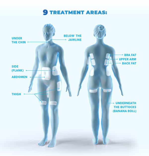 CoolSculpting 9 Treatment Areas