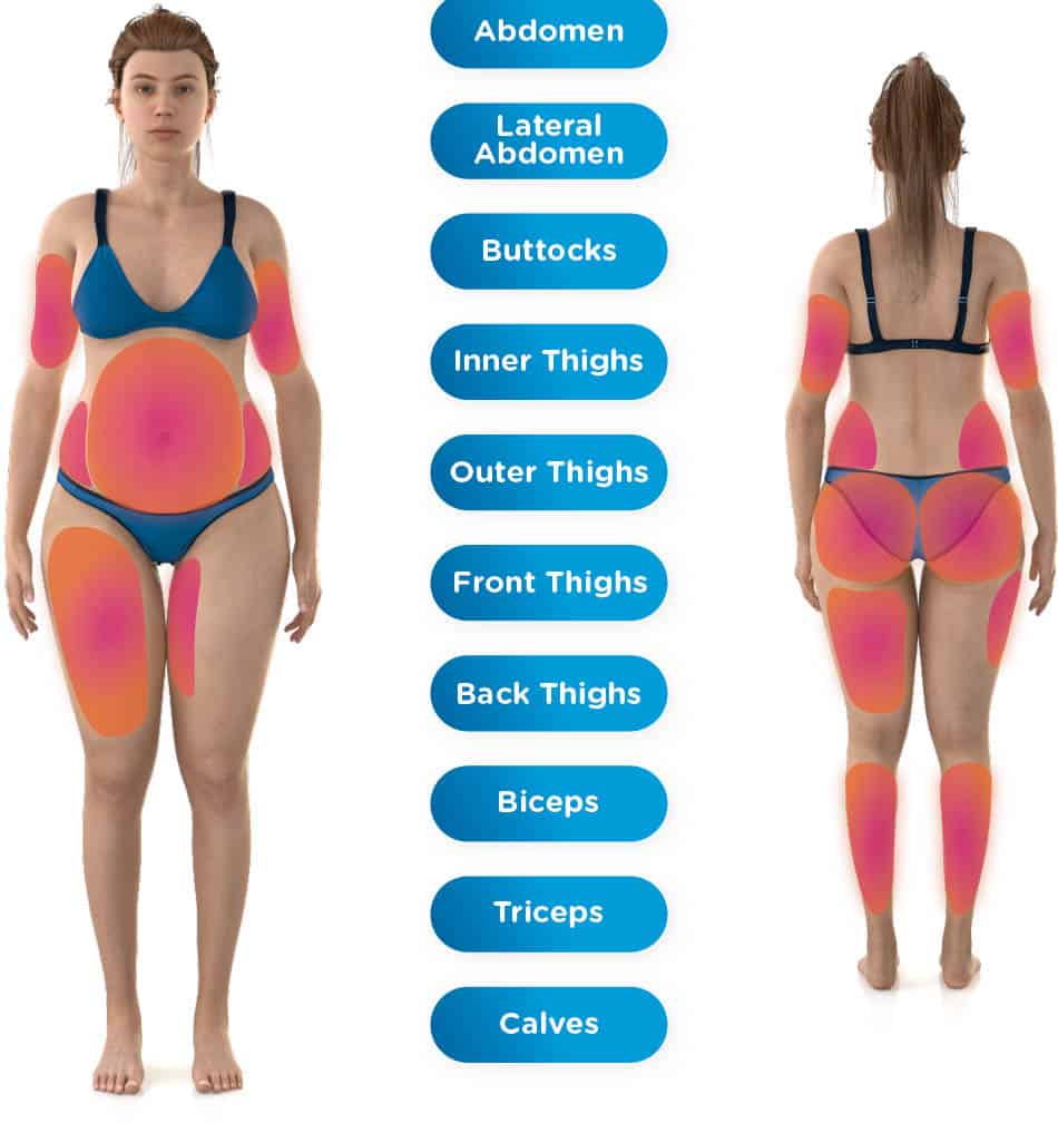 Emsculpt Neo body areas